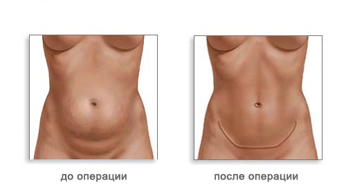 Какая тренировка помогает лучше сжечь жир