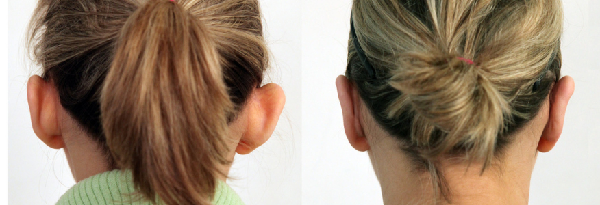 ОТОПЛАСТИКА