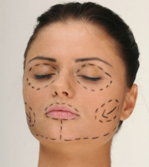 Как проходит реабилитация после SMAS-подтяжки?