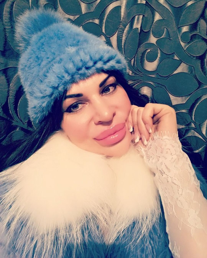 Элина Ромасенко до и после пластики: фото