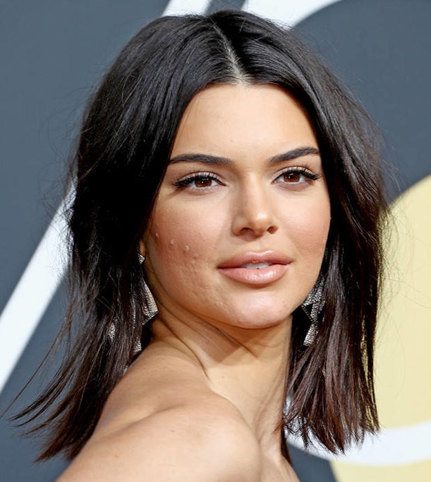 Звезды с проблемной кожей