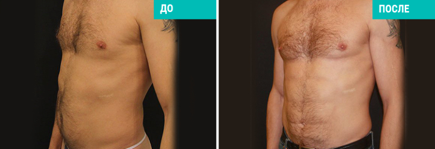 Васер для мужчин