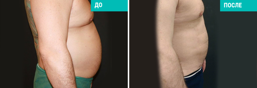 Васер для мужчин