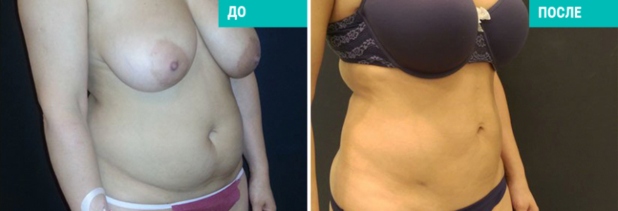 Васер моделирование тела