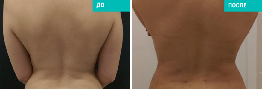 Васер моделирование тела