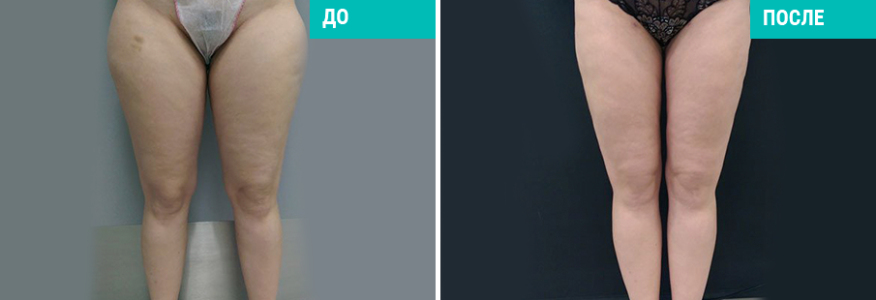 Васер моделирование тела