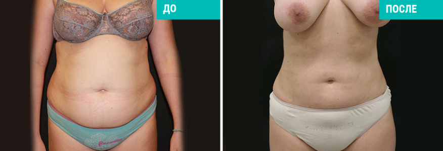 Васер моделирование тела