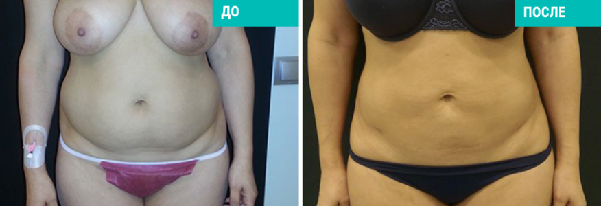 Васер моделирование тела