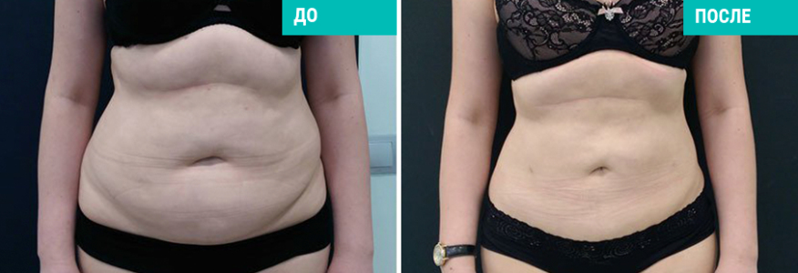 Васер моделирование тела