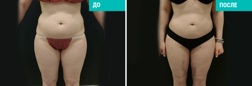 Васер моделирование тела