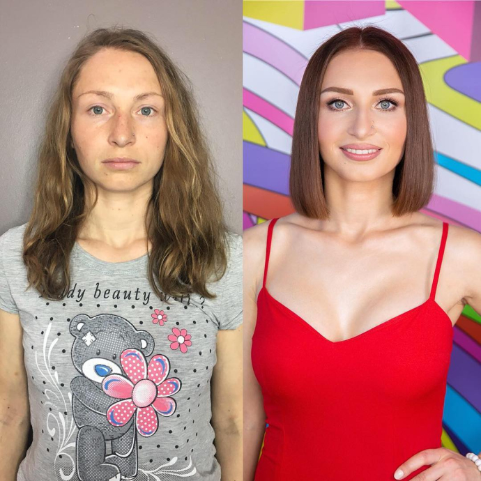 Как пластические хирурги преображают героинь «Перезагрузки»?