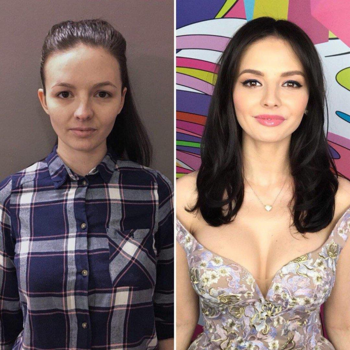 В чем тонкости пластики на ток-шоу «Перезагрузка»?