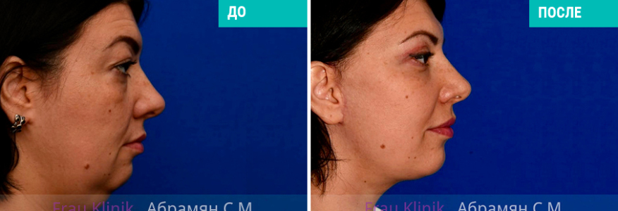 Имиджевая пластика