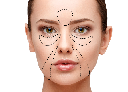 Липофилинг лица