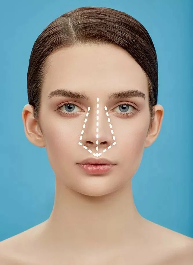 Носовые импланты