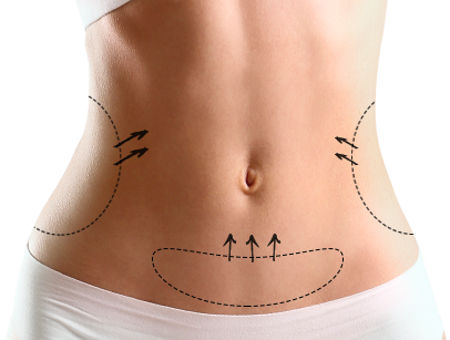 Липофилинг живота