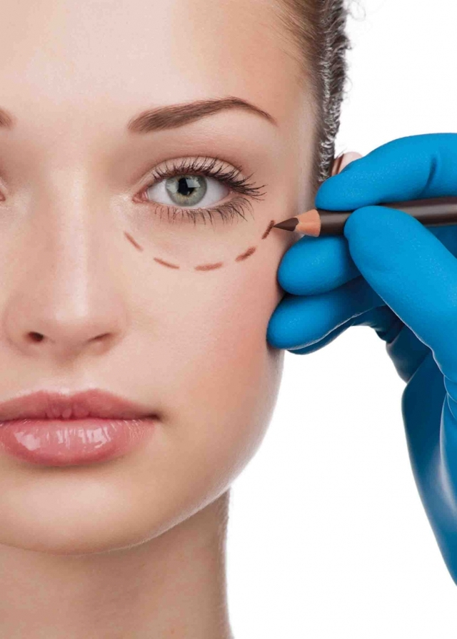 Блефаропластика под местным наркозом