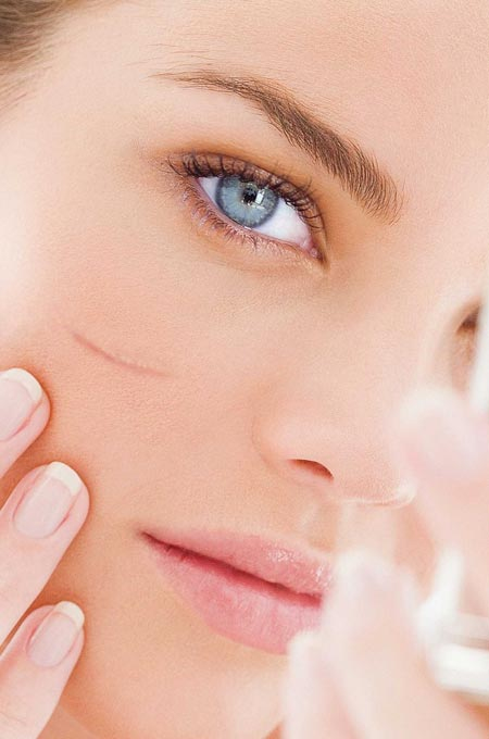 Лечение рубцов и шрамов