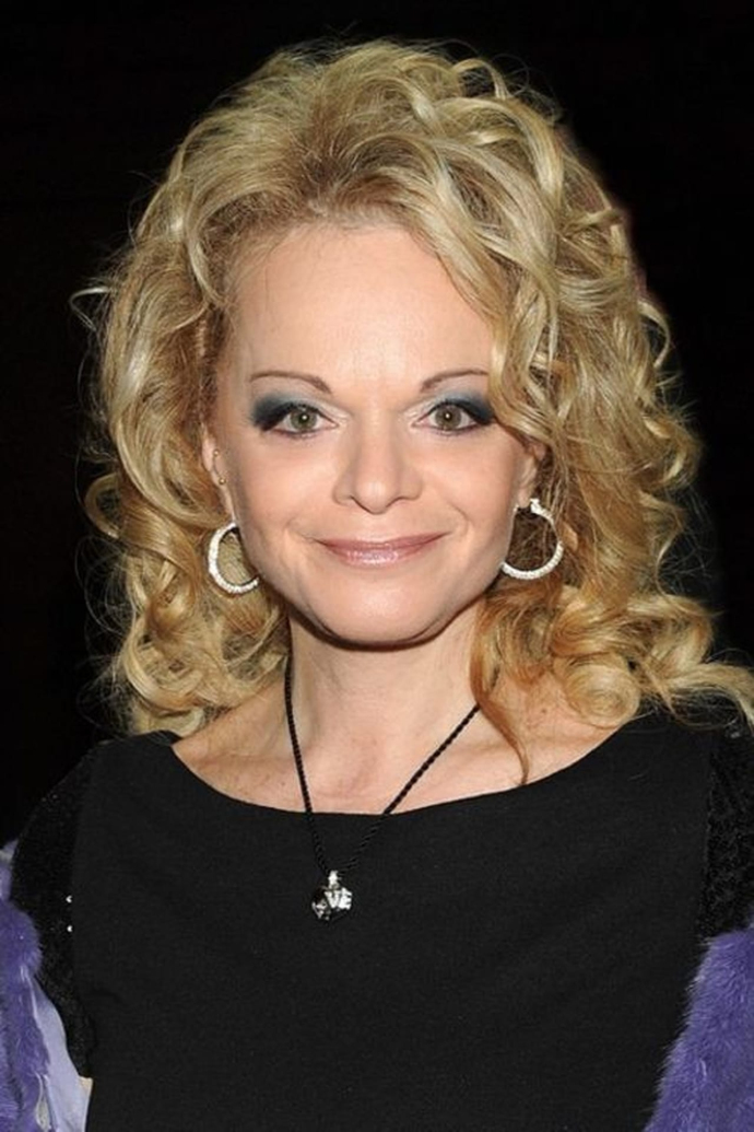 Фото Ларисы Долиной после пластики