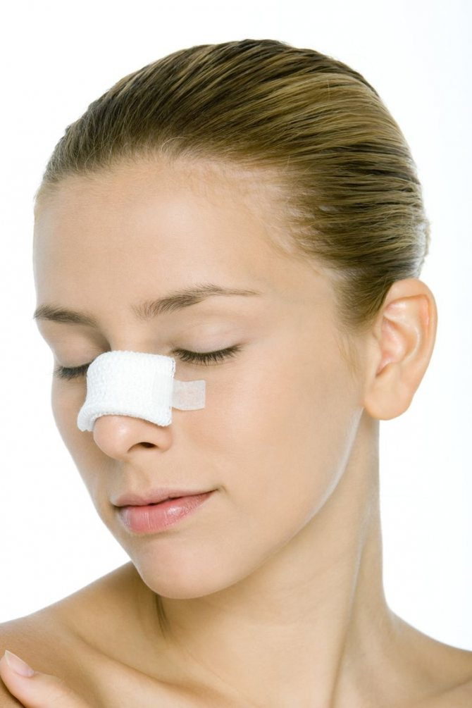 Восстановление после ринопластики