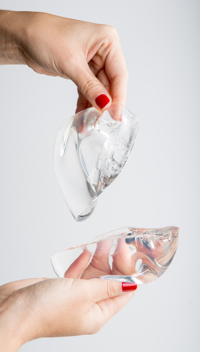 Грудные эндопротезы, размер которых можно изменить