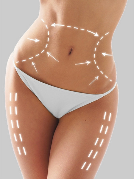 Хирургическая липосакция: преимущества и недостатки