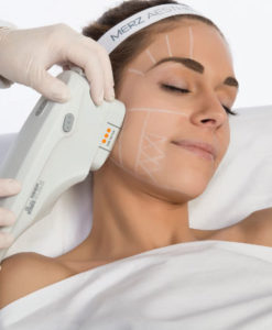 Альтера-терапия: как подтянуть лицо без операций