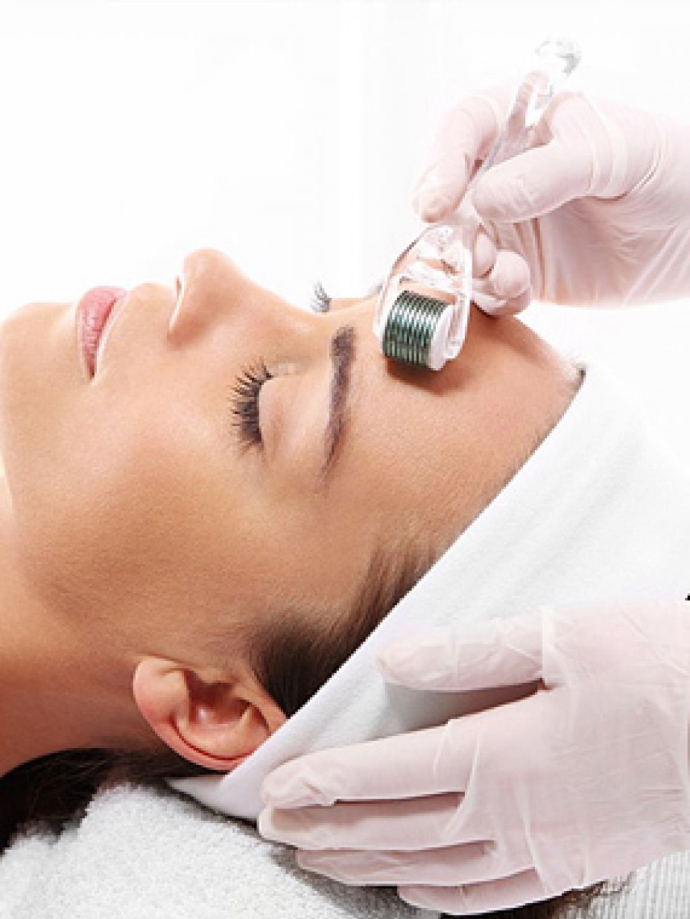 Микронидлинг. Что это за процедура?