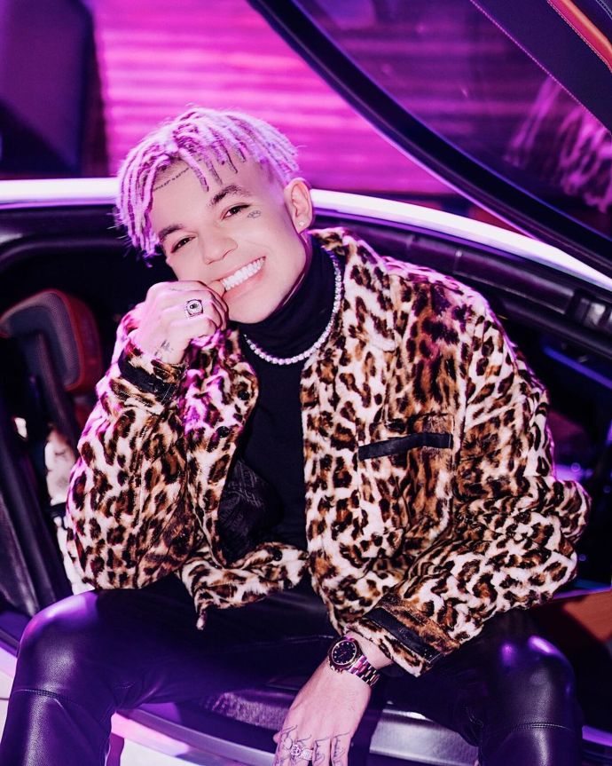 Элджей до и после пластики