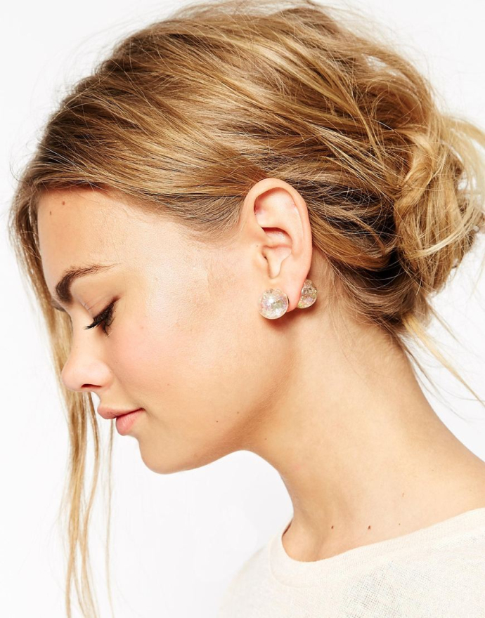 Звездная отопластика