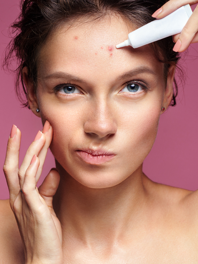 Как правильно избавиться от прыщей? Мнение косметологов