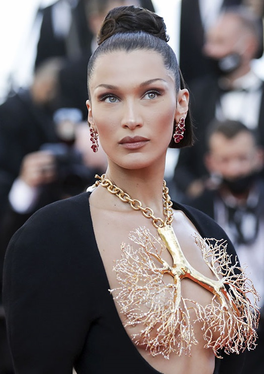 Звезды, сделавшие пластику в юности