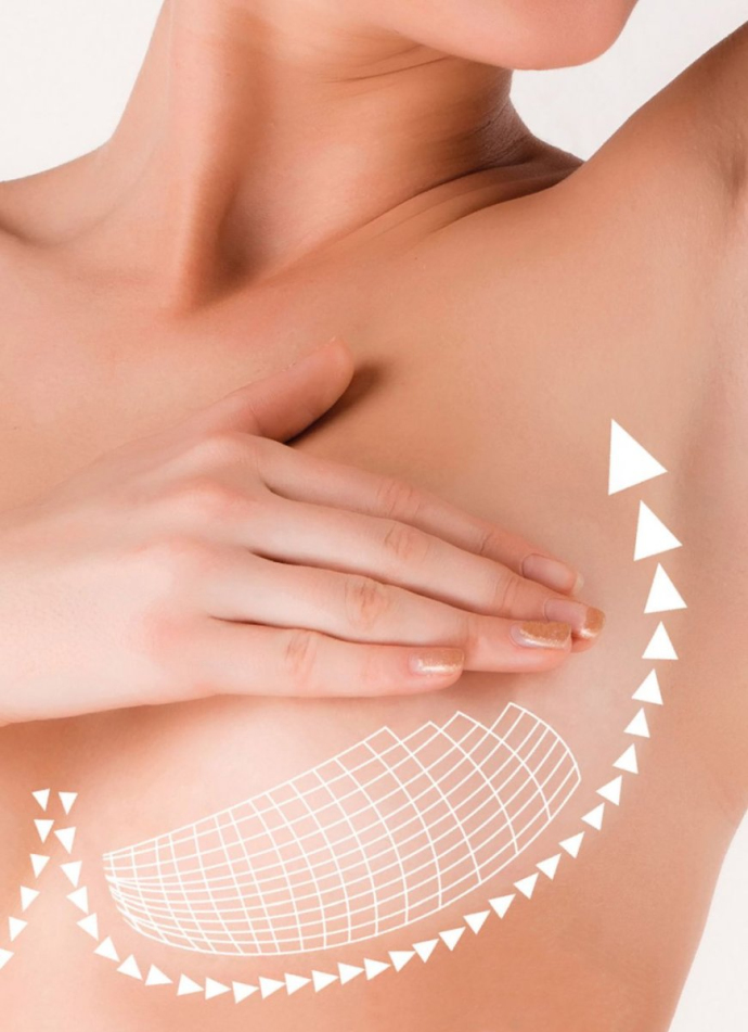 Подтяжка груди в зависимости от степени птоза