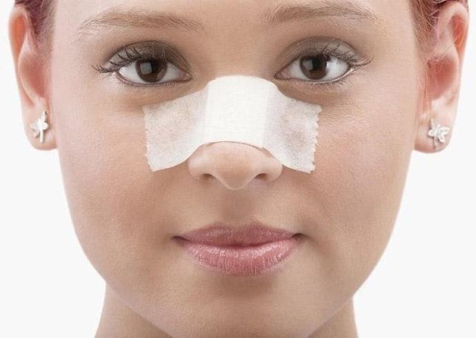 Реабилитация после ринопластики