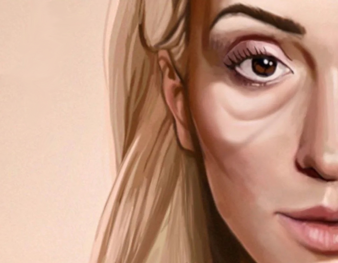 Как убрать малярные мешки?