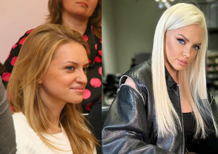 Милана Тюльпанова показала лицо до пластики, и у этой девушки нет ни одной знако