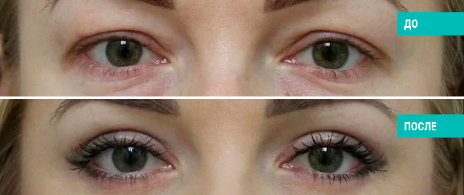 Пластический хирург В. Э. Кобазев