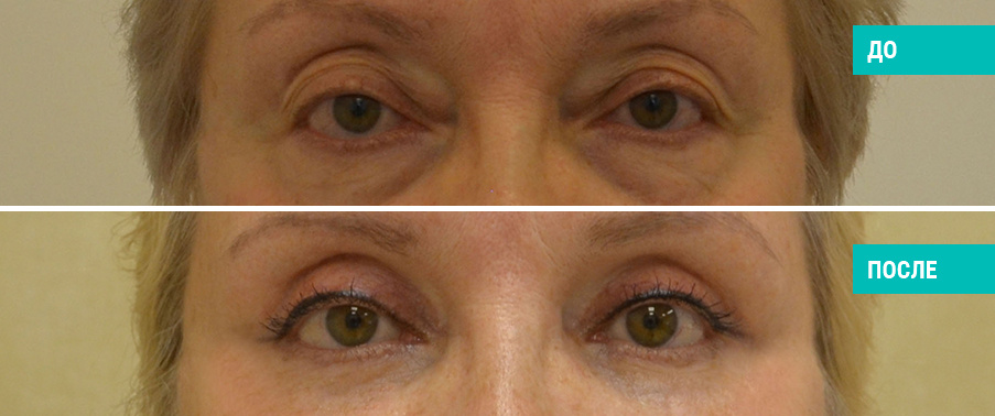 Пластический хирург О. А. Ованесова