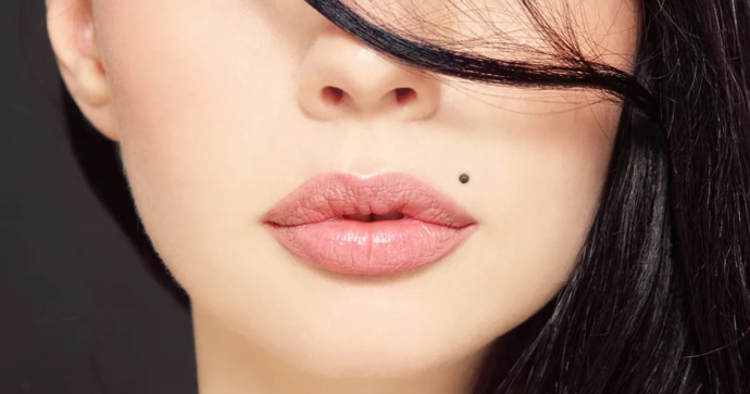 Как удалить родинки?