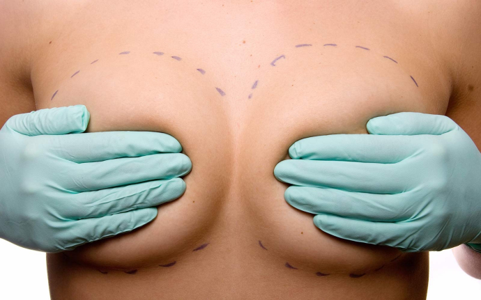 Сколько стоит пластика груди