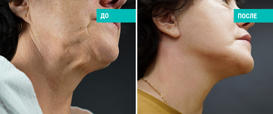 Пластический хирург Н. П. Найденов