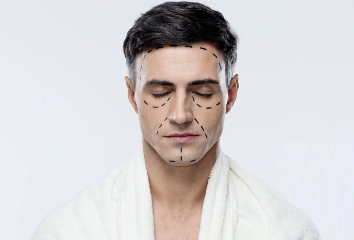 Мужская блефаропластика