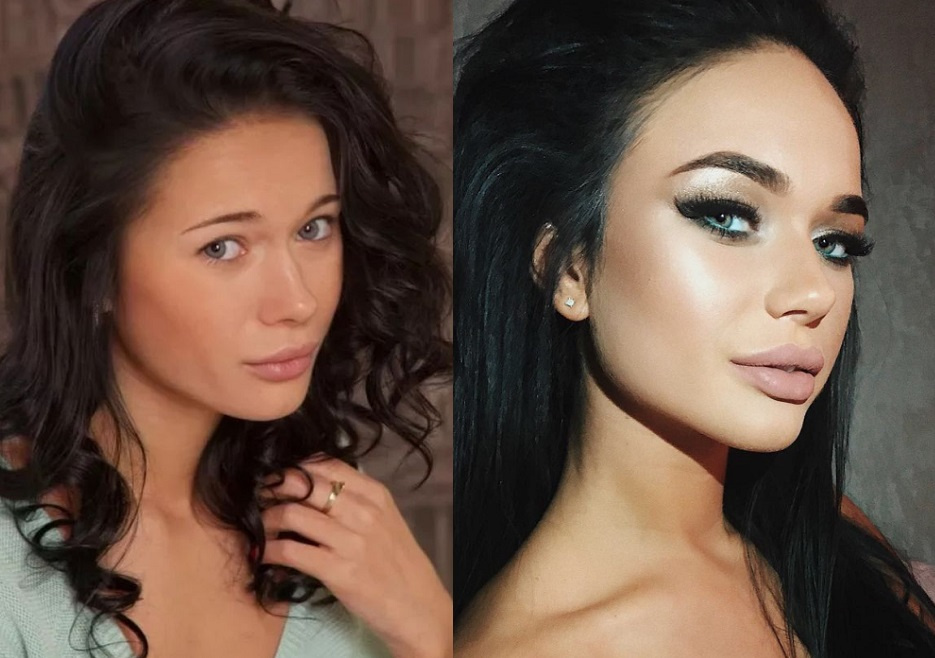 Яна Кошкина фото после пластики
