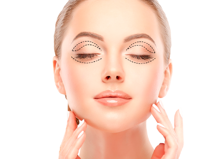 Круговая блефаропластика