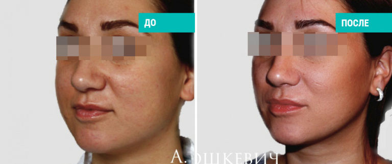 Пластический хирург А. А. Ворошкевич