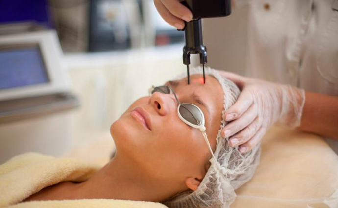 Лазерная шлифовка лица
