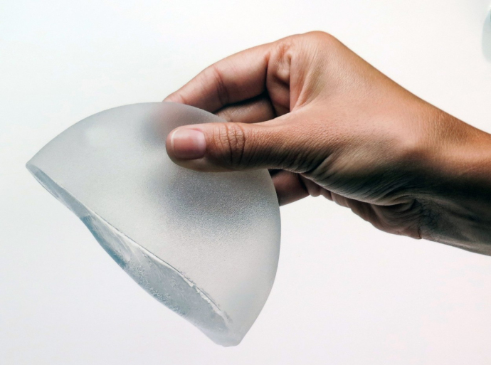 Нужно ли удалять импланты груди?