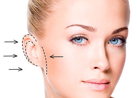 Уменьшение ушей