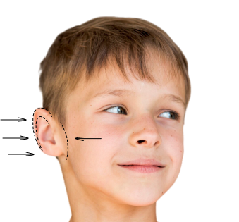 Детская отопластика