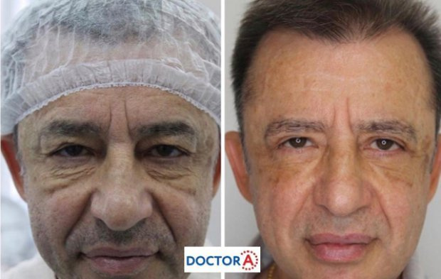 Пластический хирург Аль-Юсеф Амжад